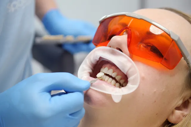 Can You Get Veneers with Gum Disease