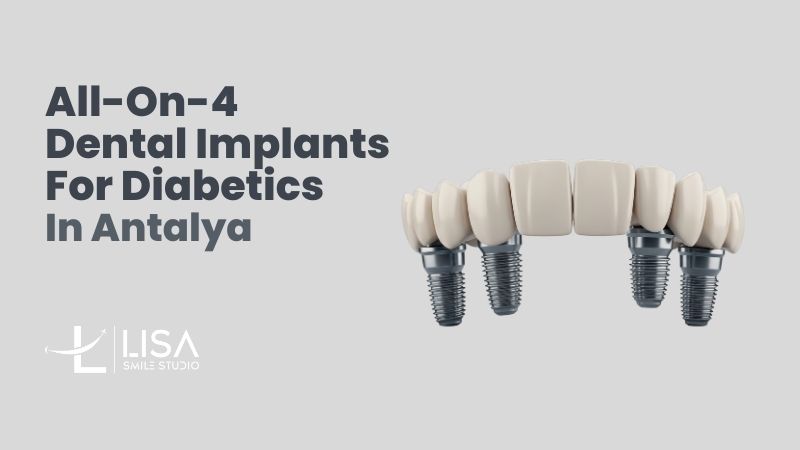 Dental implants for diabetics