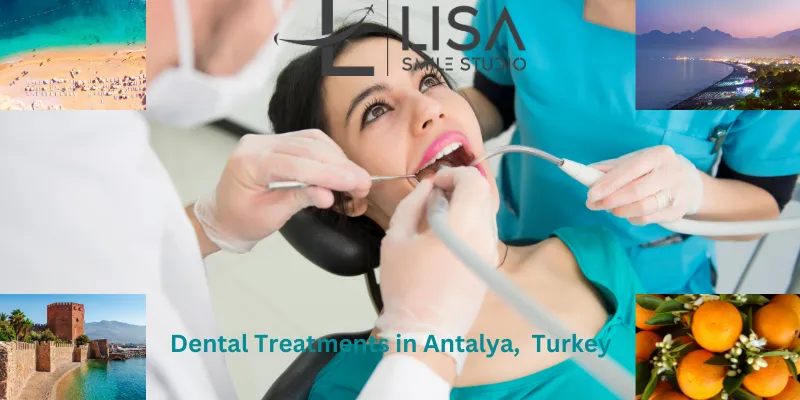 Dental Treatments in Antalya,  Turkey