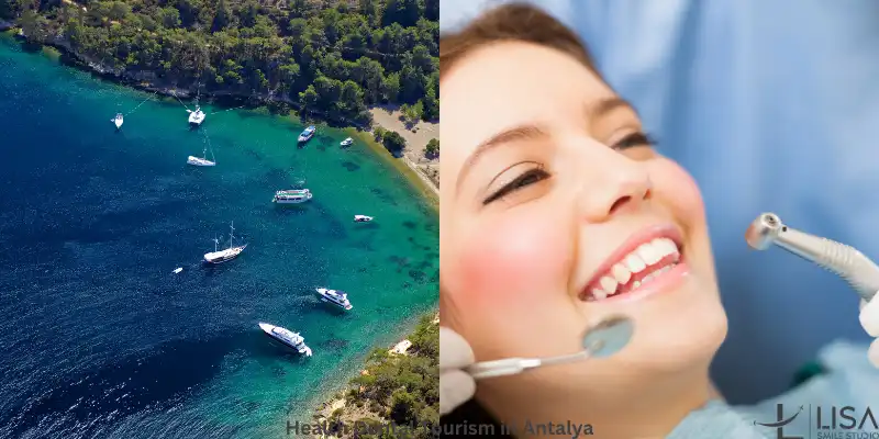 dental health tourism antalya, turkey