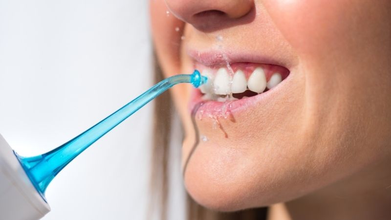 How to clean veneers at home?