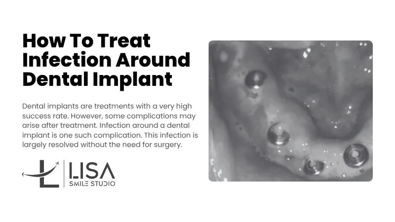 Infection around dental implant Infection around dental implant