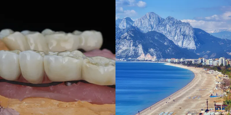 Zirconia Crowns in Turkey